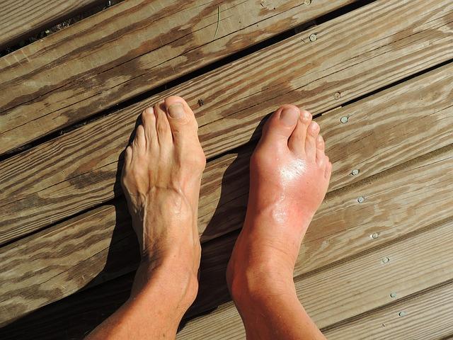 Understanding Inflammation and Its Impact on Recovery